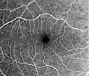 OCT angiografija